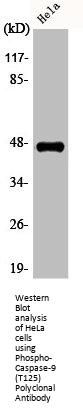 Phospho-CASP9 (T125) Antibody