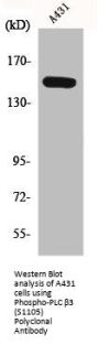 Phospho-PLCB3 (S1105) Antibody