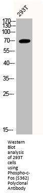 Phospho-FOS (S362) Antibody