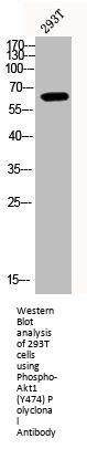 Phospho-AKT1 (Y474) Antibody