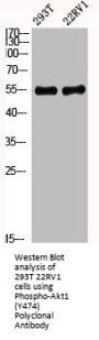 Phospho-AKT1 (Y474) Antibody