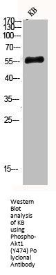 Phospho-AKT1 (Y474) Antibody