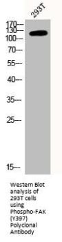 Phospho-PTK2 (Y397) Antibody