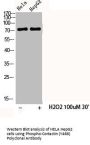 Phospho-CTTN (Y466) Antibody