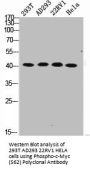 Phospho-MYC (S62) Antibody