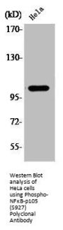 Phospho-NFKB1 (S927) Antibody