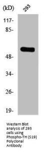Phospho-TH (S19) Antibody