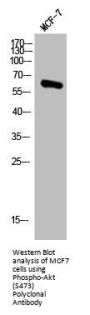 Phospho-AKT1 (S473) Antibody