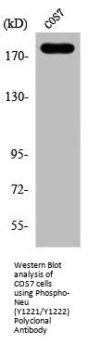 Phospho-ERBB2 (Y1221/Y1222) Antibody