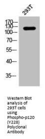 Phospho-CTNND1 (Y228) Antibody