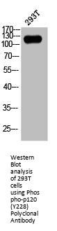 Phospho-CTNND1 (Y228) Antibody