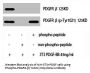 Phospho-PDGFRB (Y1021) Antibody