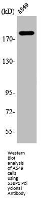 TP53BP1 Antibody