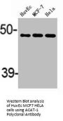ACAT1 Antibody