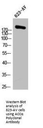ACACA Antibody