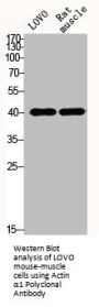ACTA1 Antibody