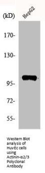 ACTN2/ACTN3 Antibody