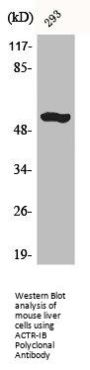ACVR1B Antibody