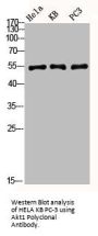 AKT1 Antibody