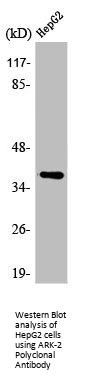 AURKB Antibody