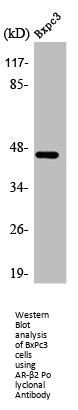 ADRB2 Antibody