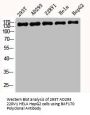 SMARCC2 Antibody
