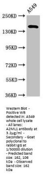 A2ML1 Antibody