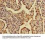 A2ML1 Antibody