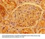 AACS Antibody