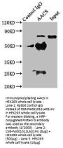 AACS Antibody