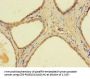 AADAC Antibody