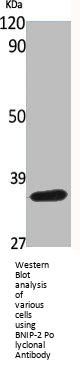 BNIP-2 Polyclonal Antibody