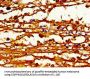 ABCB4 Antibody