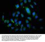 ABCB4 Antibody