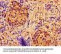 ABCB7 Antibody