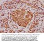 ABCD4 Antibody
