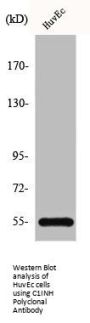 C1INH Polyclonal Antibody