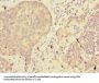 ABHD2 Antibody