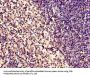 ABHD2 Antibody