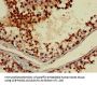 ABI2 Antibody
