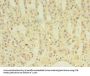 ABLIM3 Antibody