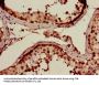 ABLIM3 Antibody
