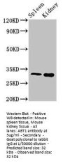 ABT1 Antibody