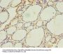 ACAA1 Antibody