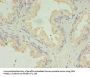 ACAA1 Antibody
