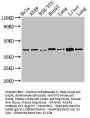 ACAA2 Antibody