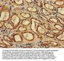 ACAA2 Antibody