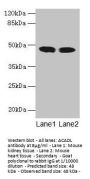 ACADL Antibody