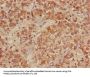 ACADL Antibody