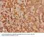 ACADL Antibody
